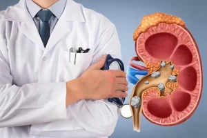 دراسة دكتوراه أمراض الكلى في مصر للوافدين